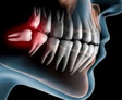Cirugia Bucal Maxilofacial