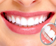 Limpieza dental