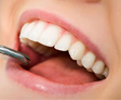 Limpieza dental