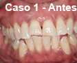 Ortodoncia Dental