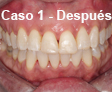 Ortodoncia Dental
