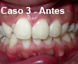 Ortodoncia Dental