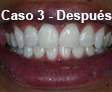 Ortodoncia Dental