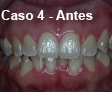 Ortodoncia Dental