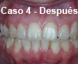 Ortodoncia Dental