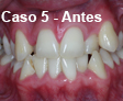 Ortodoncia Dental