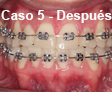 Ortodoncia Dental