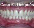 Ortodoncia Dental
