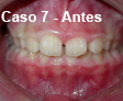 Ortodoncia Dental