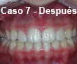 Ortodoncia Dental