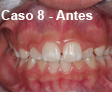 Ortodoncia Dental