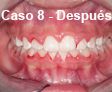 Ortodoncia Dental