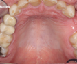 rehabilitacion oral
