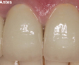 rehabilitacion oral