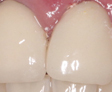 rehabilitacion Oral