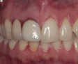 rehabilitacion oral