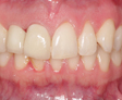 rehabilitacion Oral