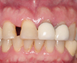 rehabilitacion oral