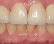 rehabilitacion Oral