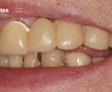 rehabilitacion oral