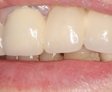 rehabilitacion Oral