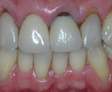 rehabilitacion oral
