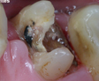rehabilitacion oral