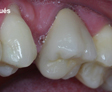 rehabilitacion Oral