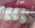 Restauraciones Estéticas