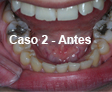 Restauraciones Estéticas