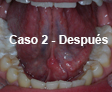 Restauraciones Estéticas