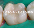 Restauraciones Estéticas