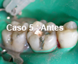 Restauraciones Estéticas