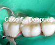 Restauraciones Estéticas