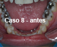 Restauraciones Estéticas