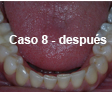 Restauraciones Estéticas