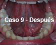 Restauraciones Estéticas